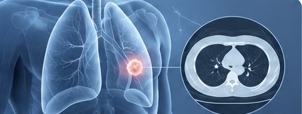 “Lung