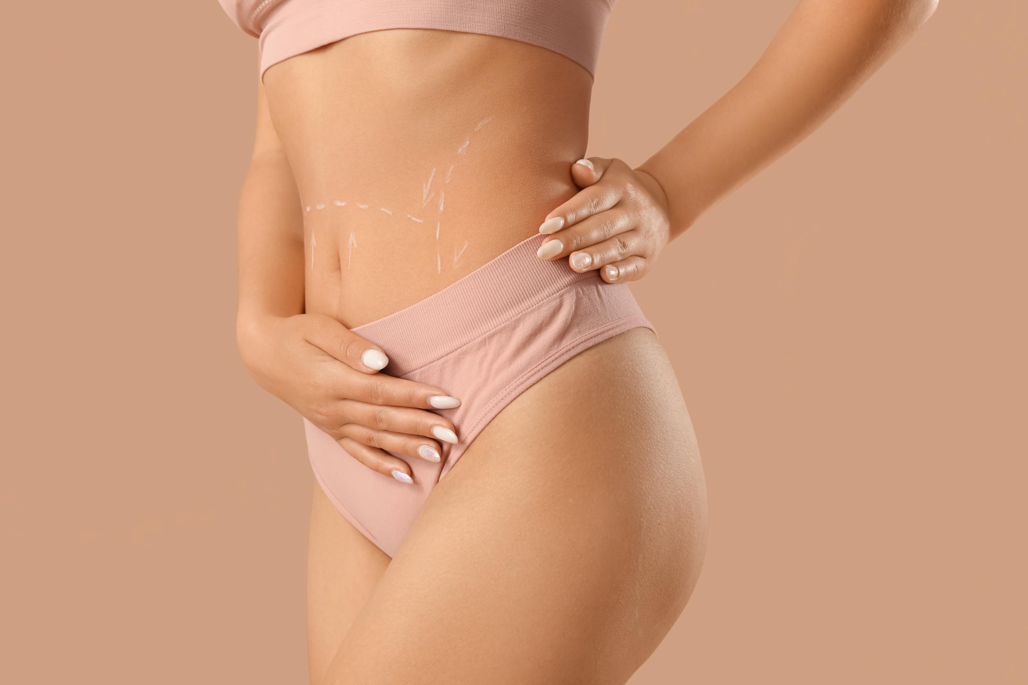 Side view of a woman in pink underwear with white cosmetic marks on her abdomen and hands on her waist.