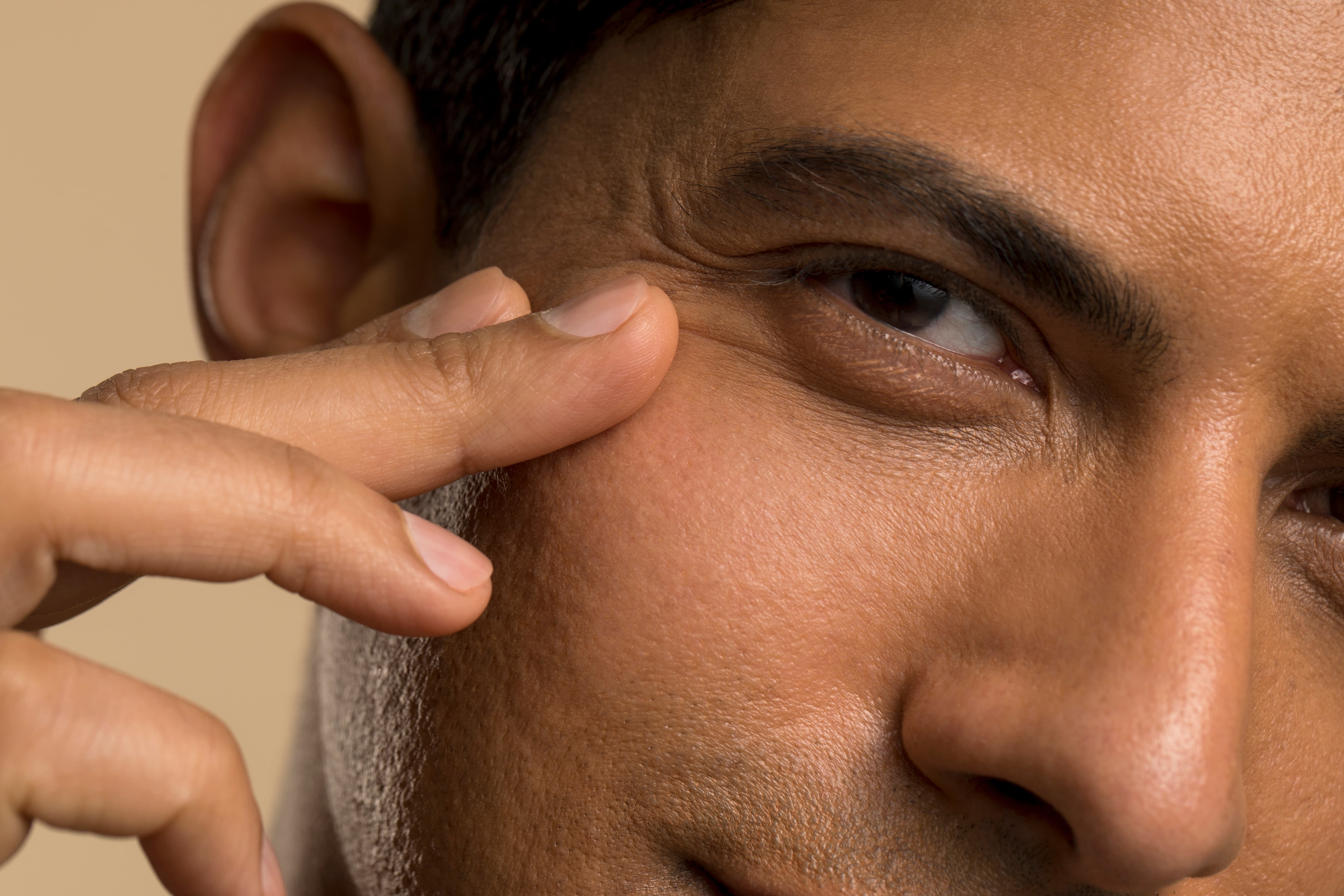 Close-up of a man gently pinching skin near his eye and cheek with his fingers.