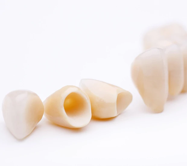 Close-up of several dental crown prosthetics arranged on a white surface.