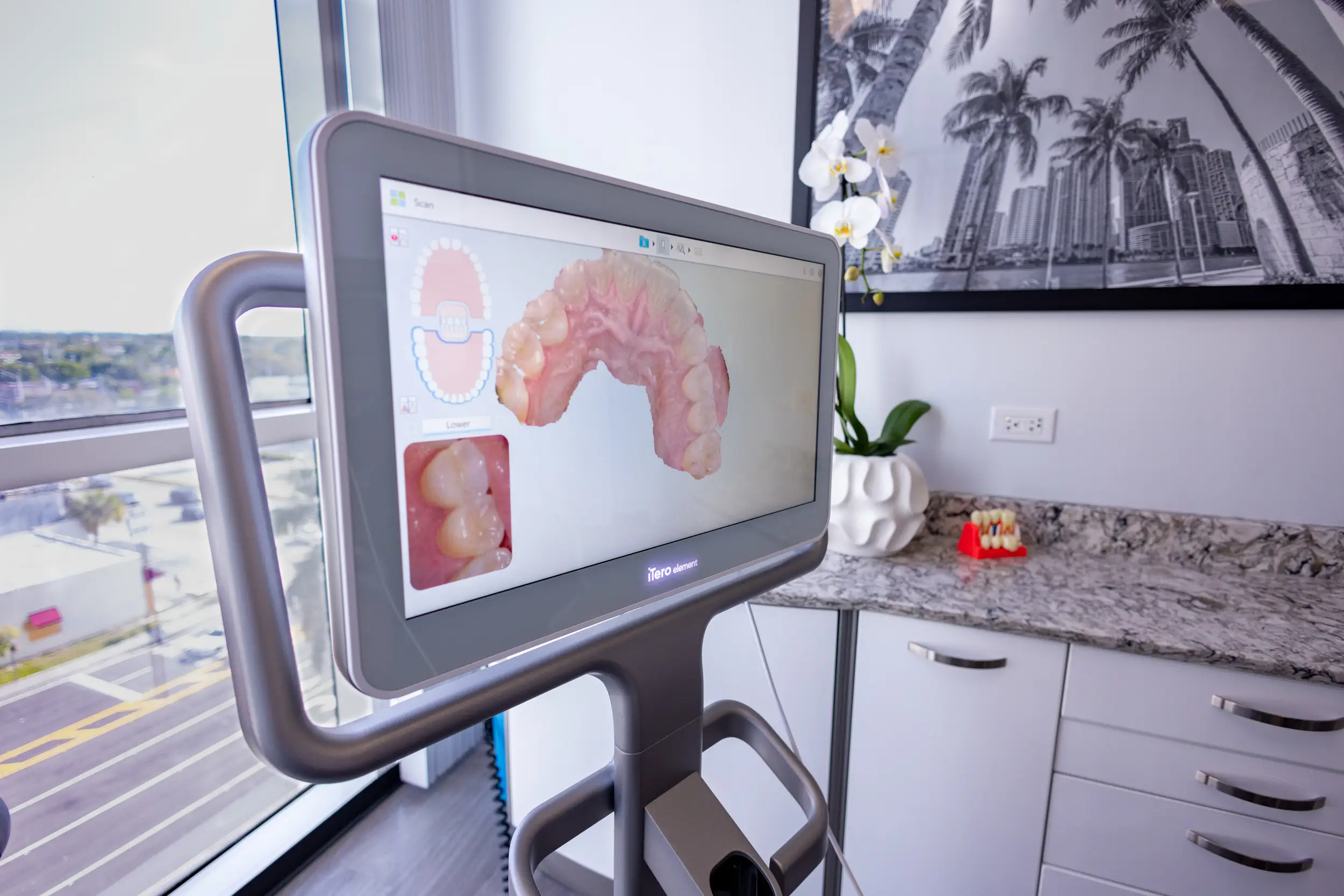 Digital dental scanner screen displaying a 3D model of a patient's upper teeth in a bright dental office.