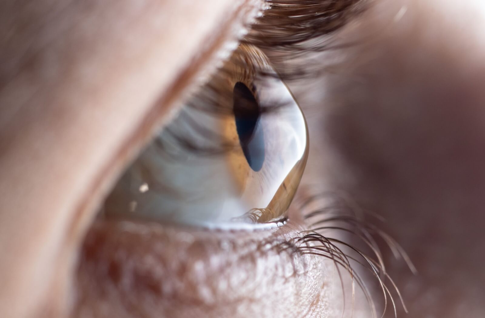 Scleral contact lens fitting appointment at Toronto Vision Therapy and Optometry