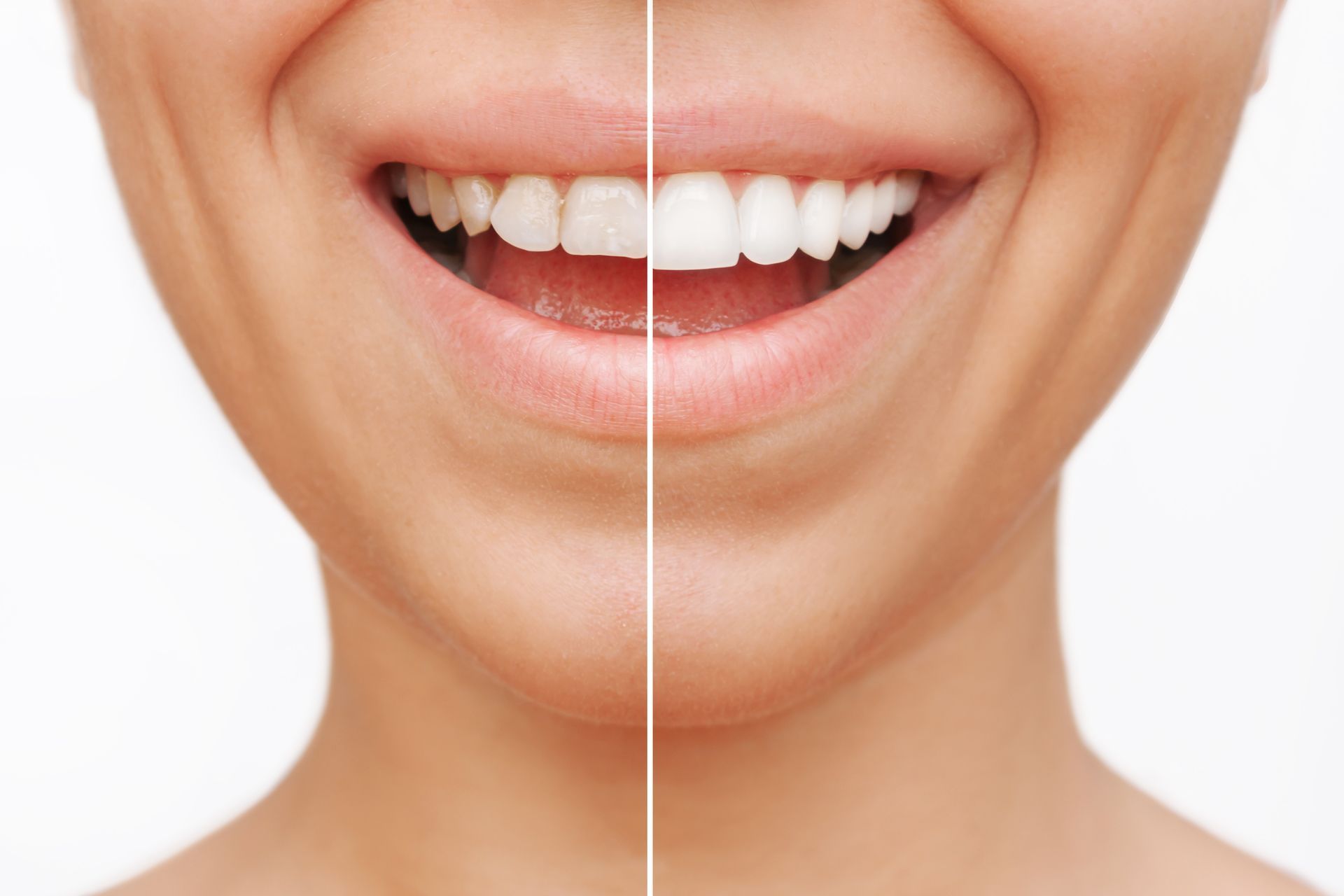 Young woman with a new smile, highlighting cosmetic dental services for smile makeovers.