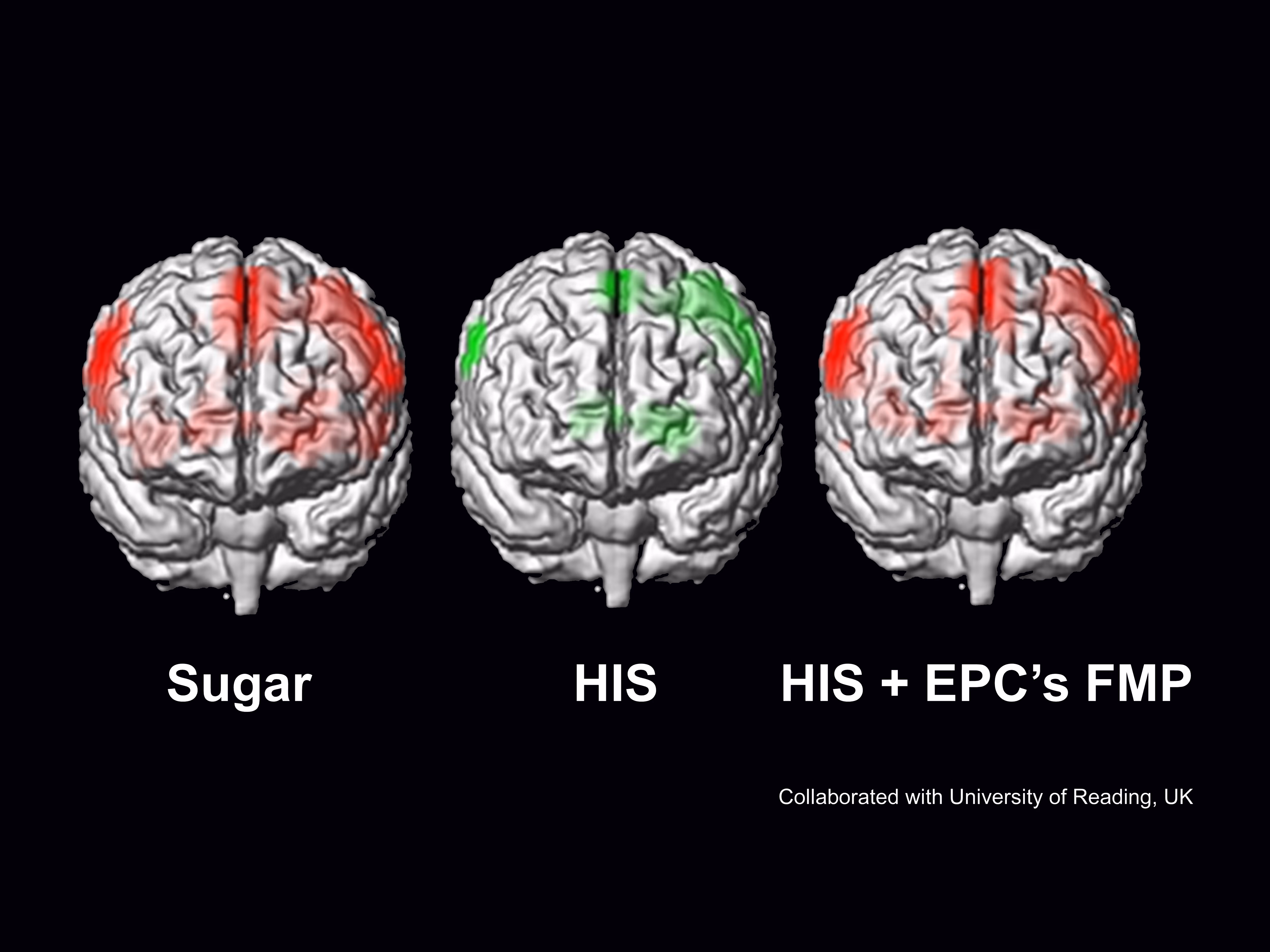 Three brain scans labeled Sugar, HIS, and HIS + EPC's FMP with red and green highlighted areas.
