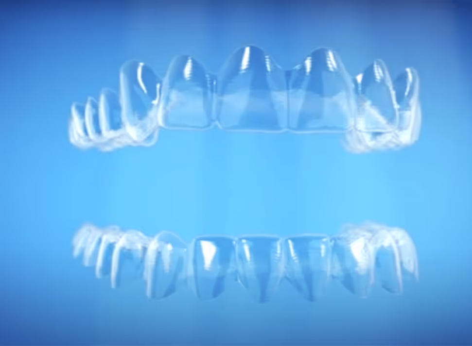 Transparent clear dental aligners for upper and lower teeth on a blue background.