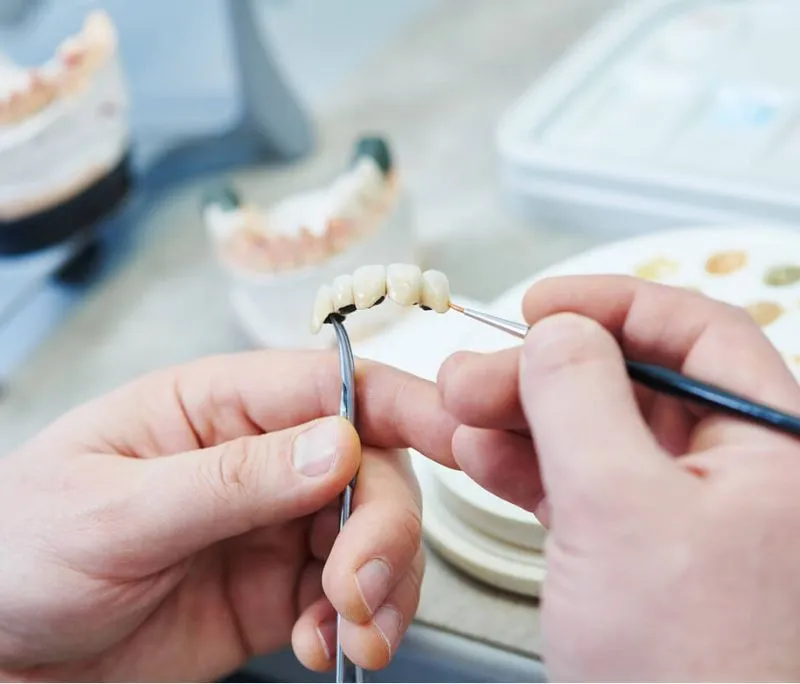 Hands holding dental veneers while applying paint with a small brush in a dental lab.
