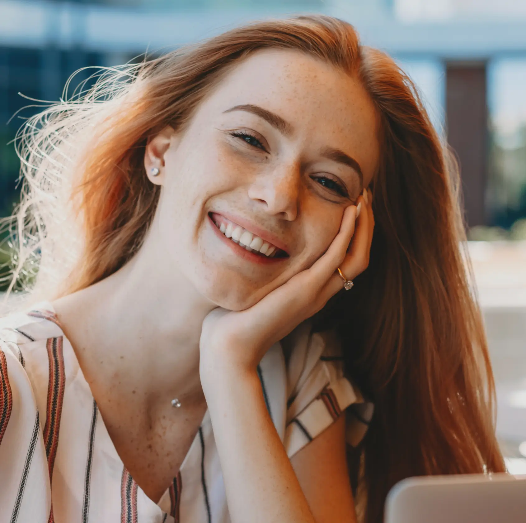 Smiling red-haired woman resting face on hand wearing striped shirt and diamond ring indoors. La Perle Dental Center in Edmonton, AB TST 3T9