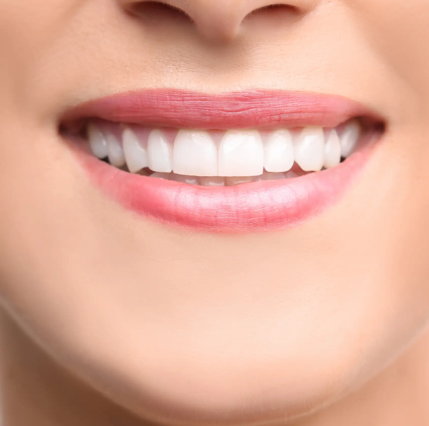 Close-up of a smiling mouth showing white, well-aligned teeth and pink lips. La Perle Dental Center in Edmonton, AB TST 3T9