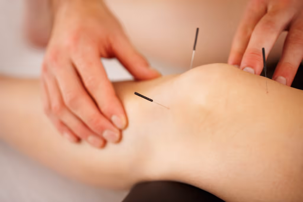 Aiguilletage sec - Urgence Physio