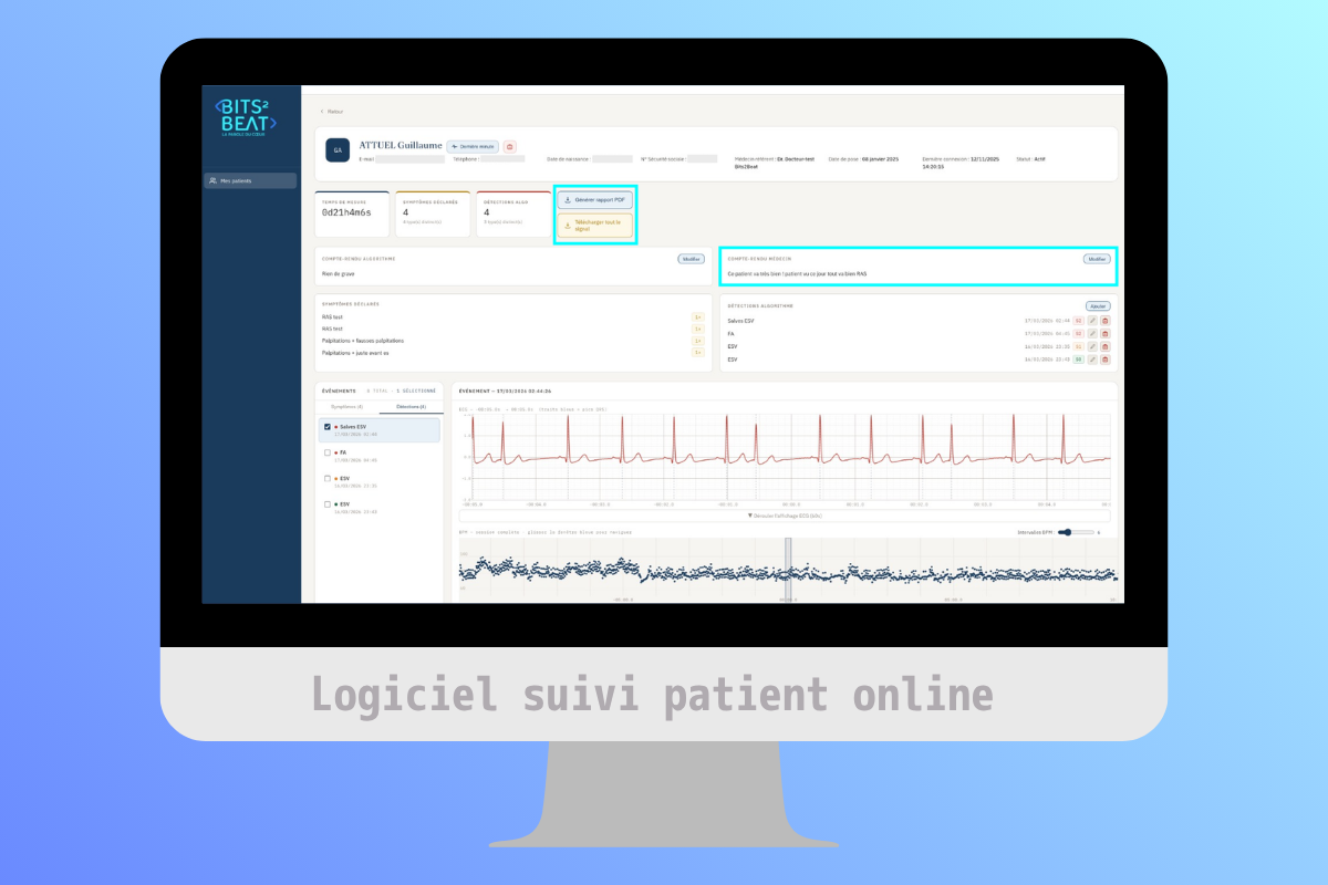 Écran d'ordinateur montrant un logiciel de suivi patient avec graphiques ECG et données médicales.