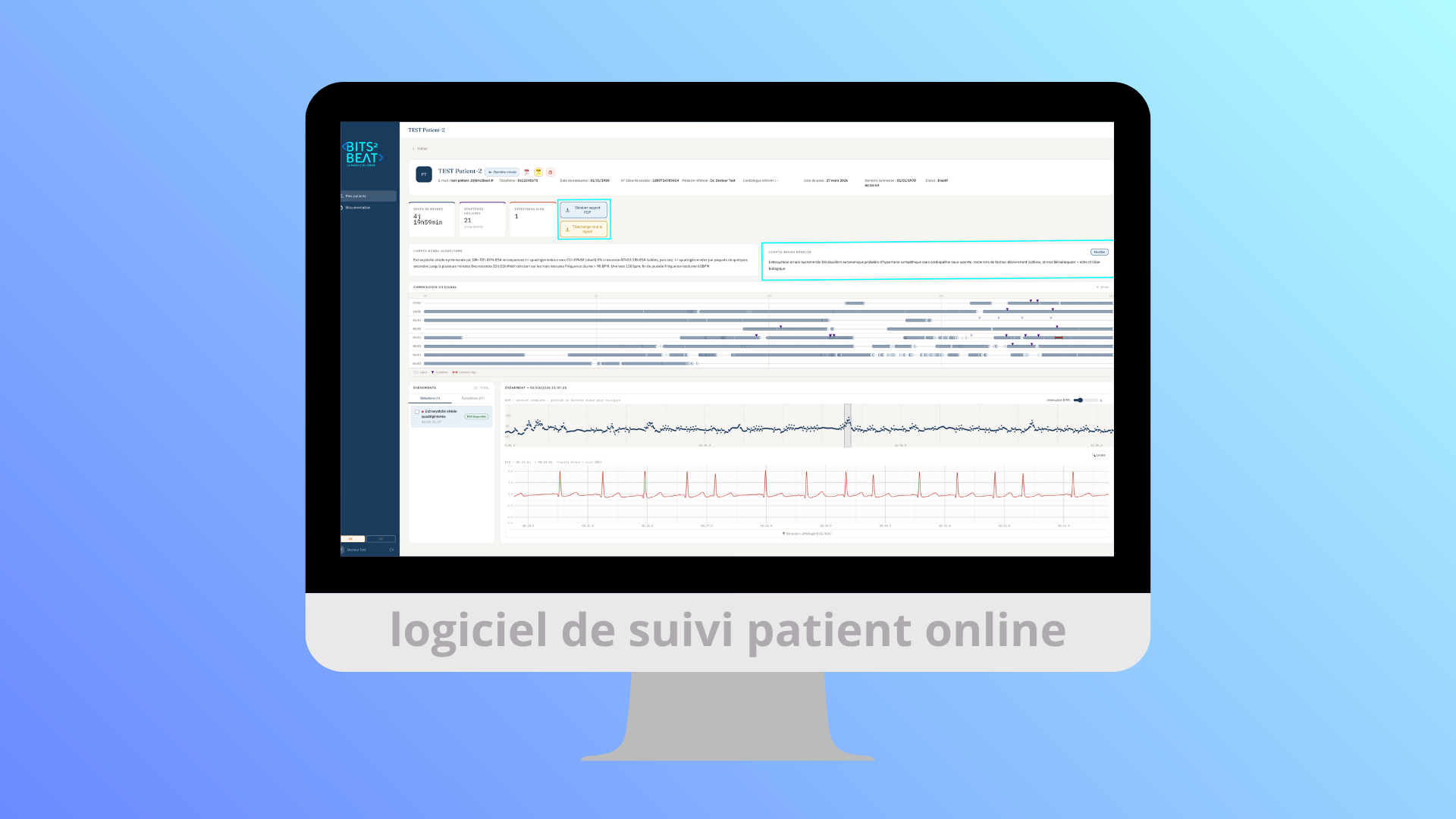 Écran d'ordinateur montrant un logiciel de suivi patient avec graphiques ECG et données médicales.