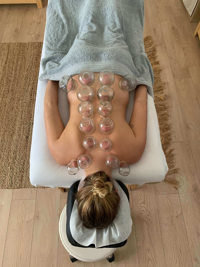 Cupping therapy