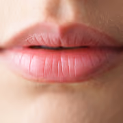 Lip plumping with dermal filler.