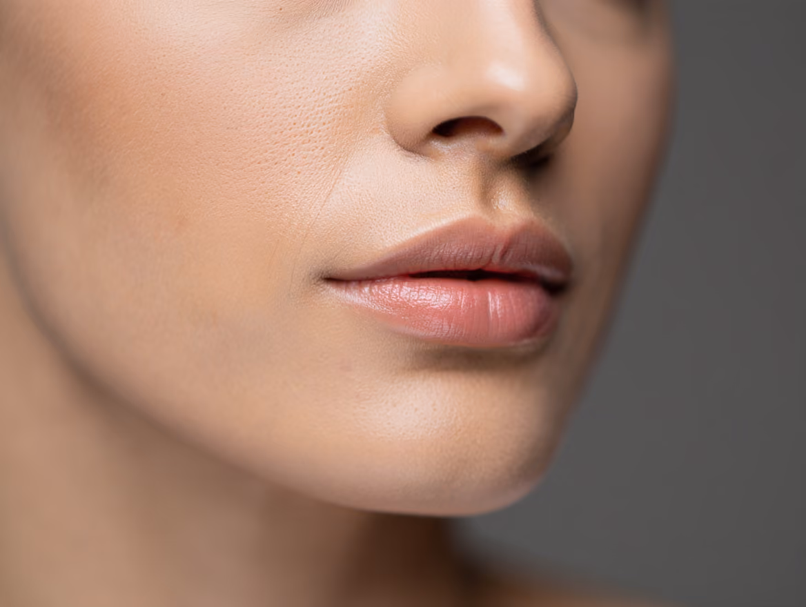 Jawline definition with dermal filler.