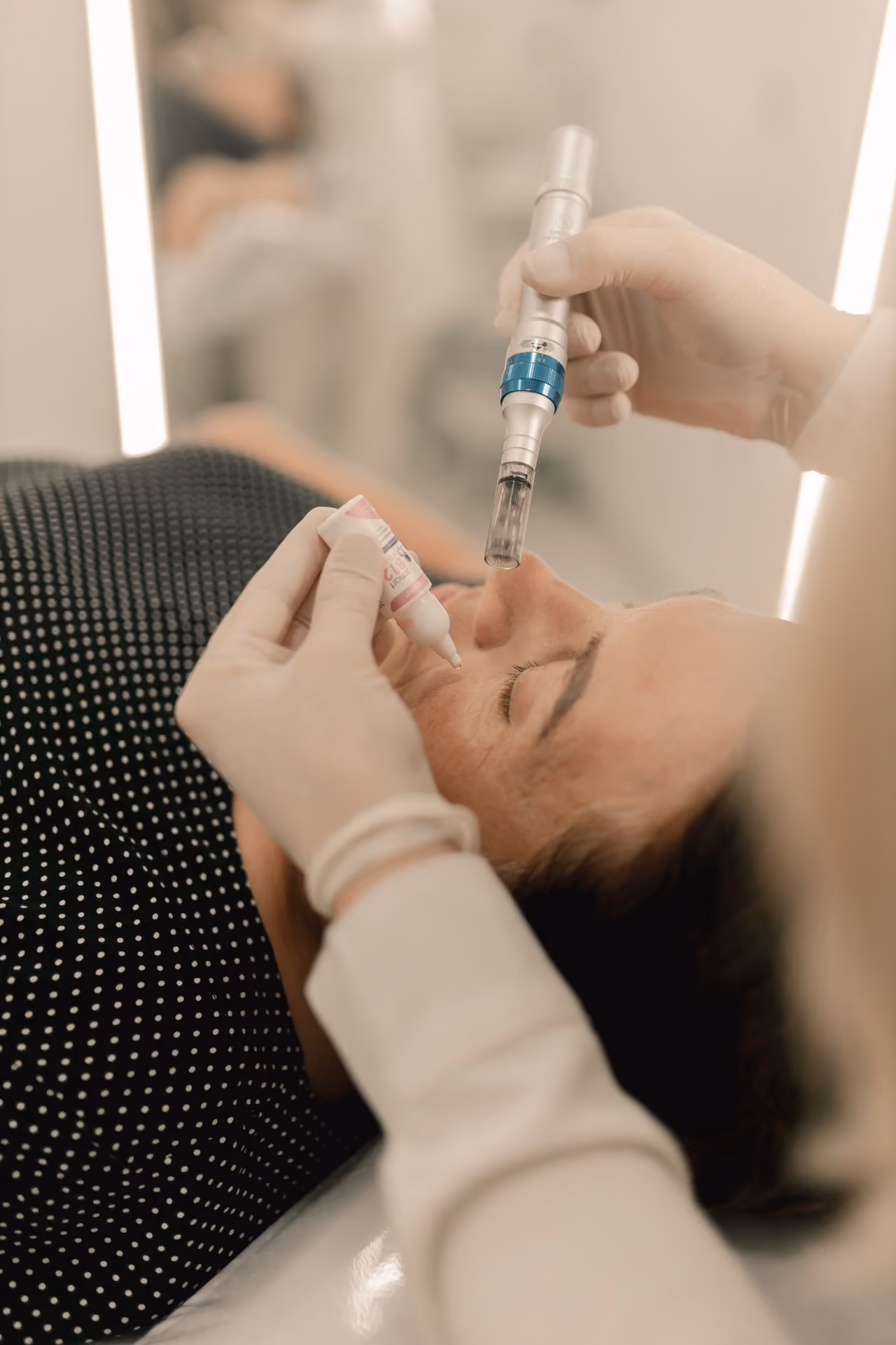 Microneedling treatment at Unify Care.