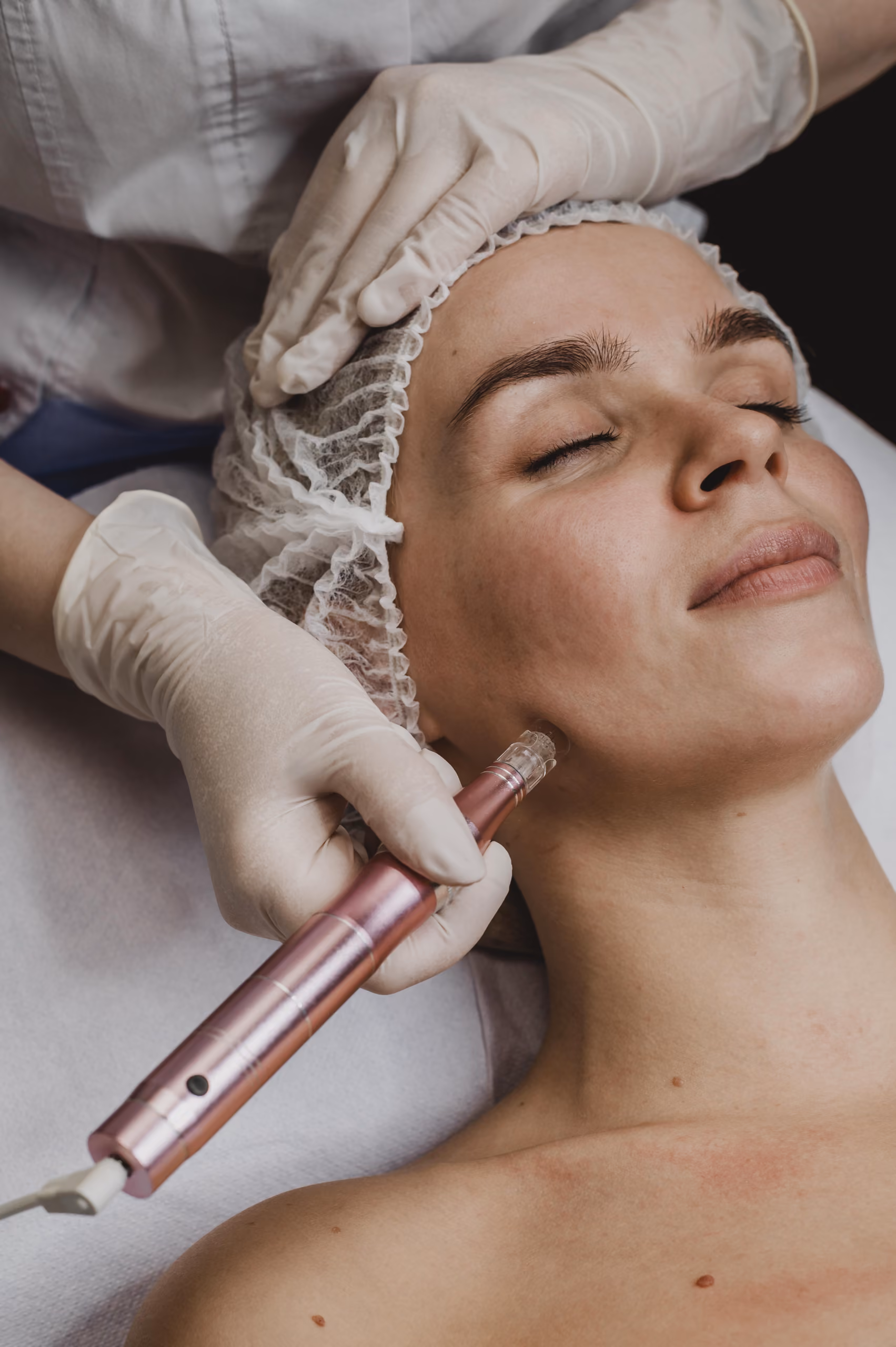 Dermal filler treatment being performed at Unify Care in Redlands.