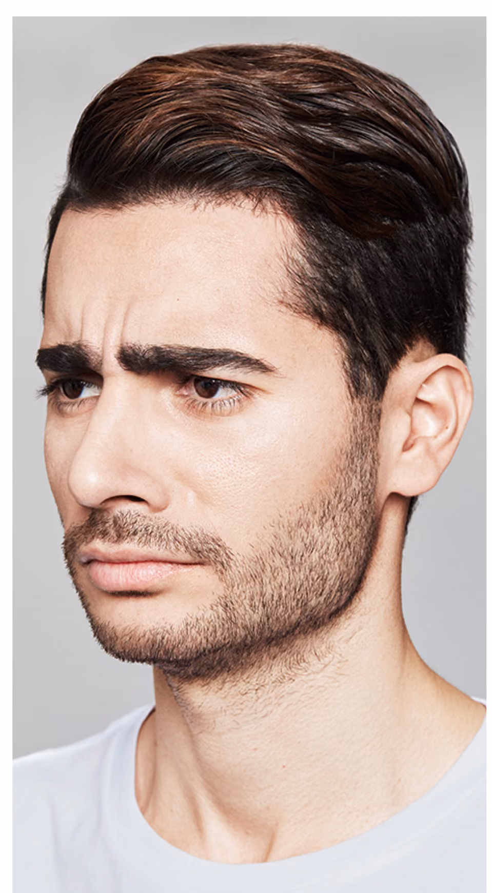 Botox treatment before.