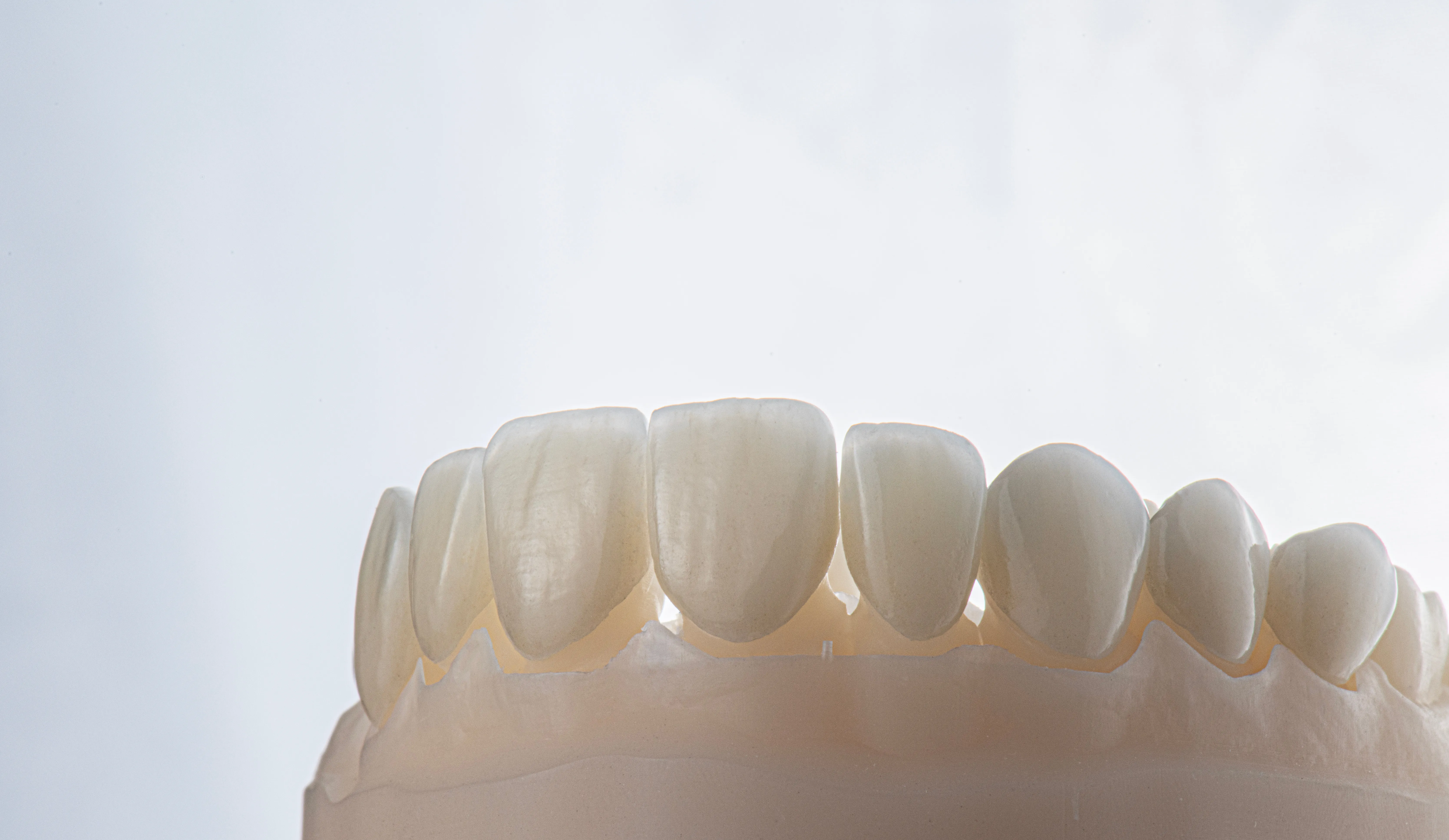 Full-arch dental model with natural-looking prosthetic teeth