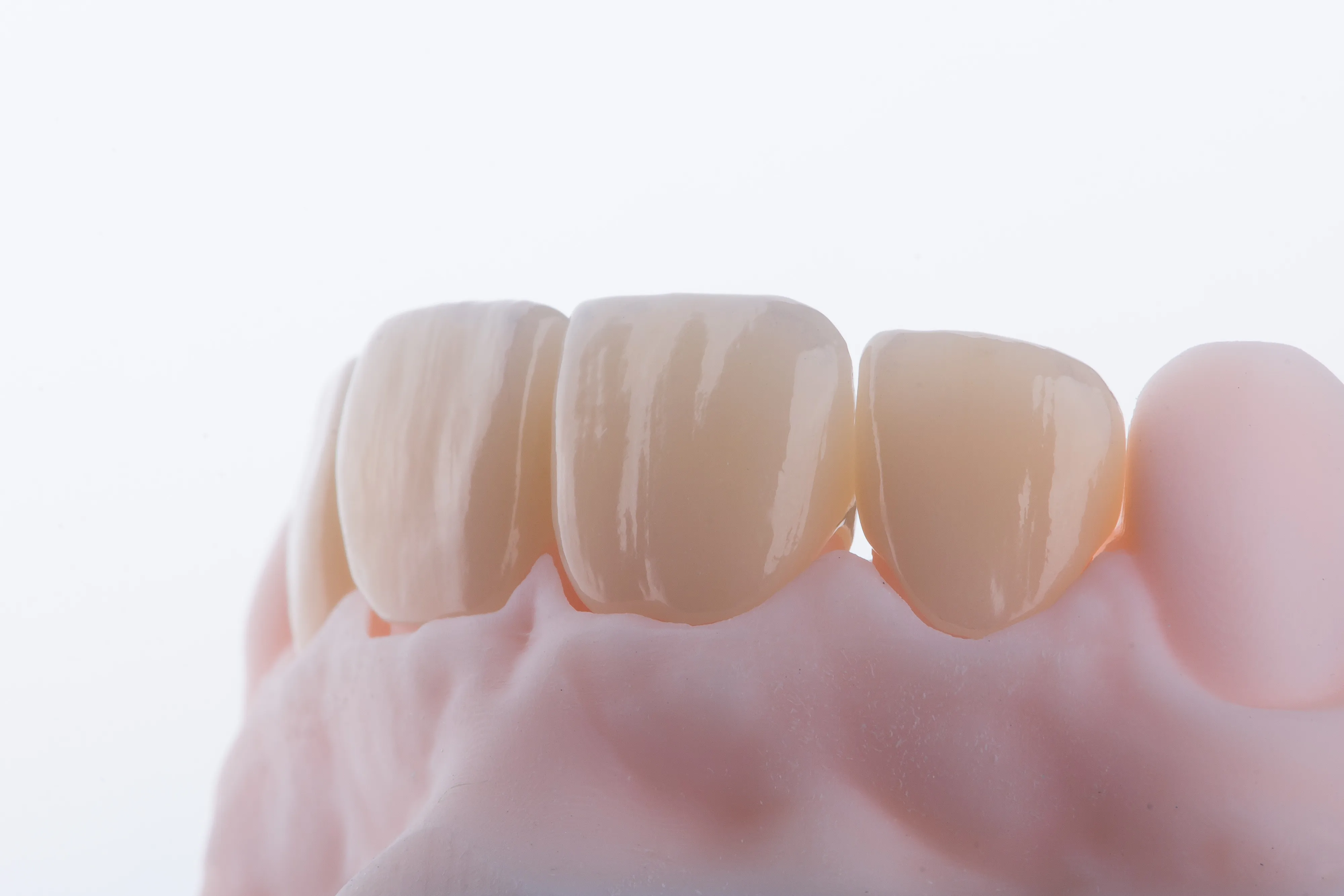 Close-up of dental crowns and prosthetic teeth on a dental model