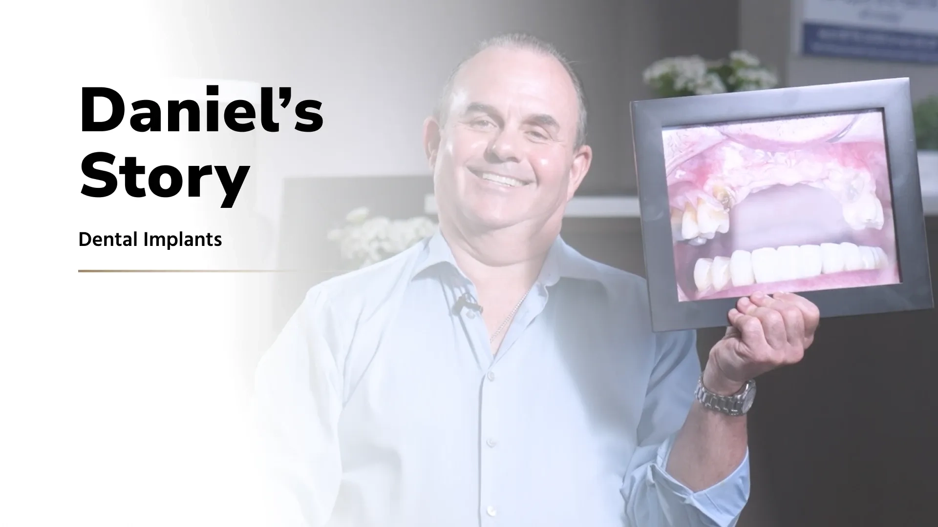 Patient testimonial video: Daniel discussing results from full-arch implant treatment