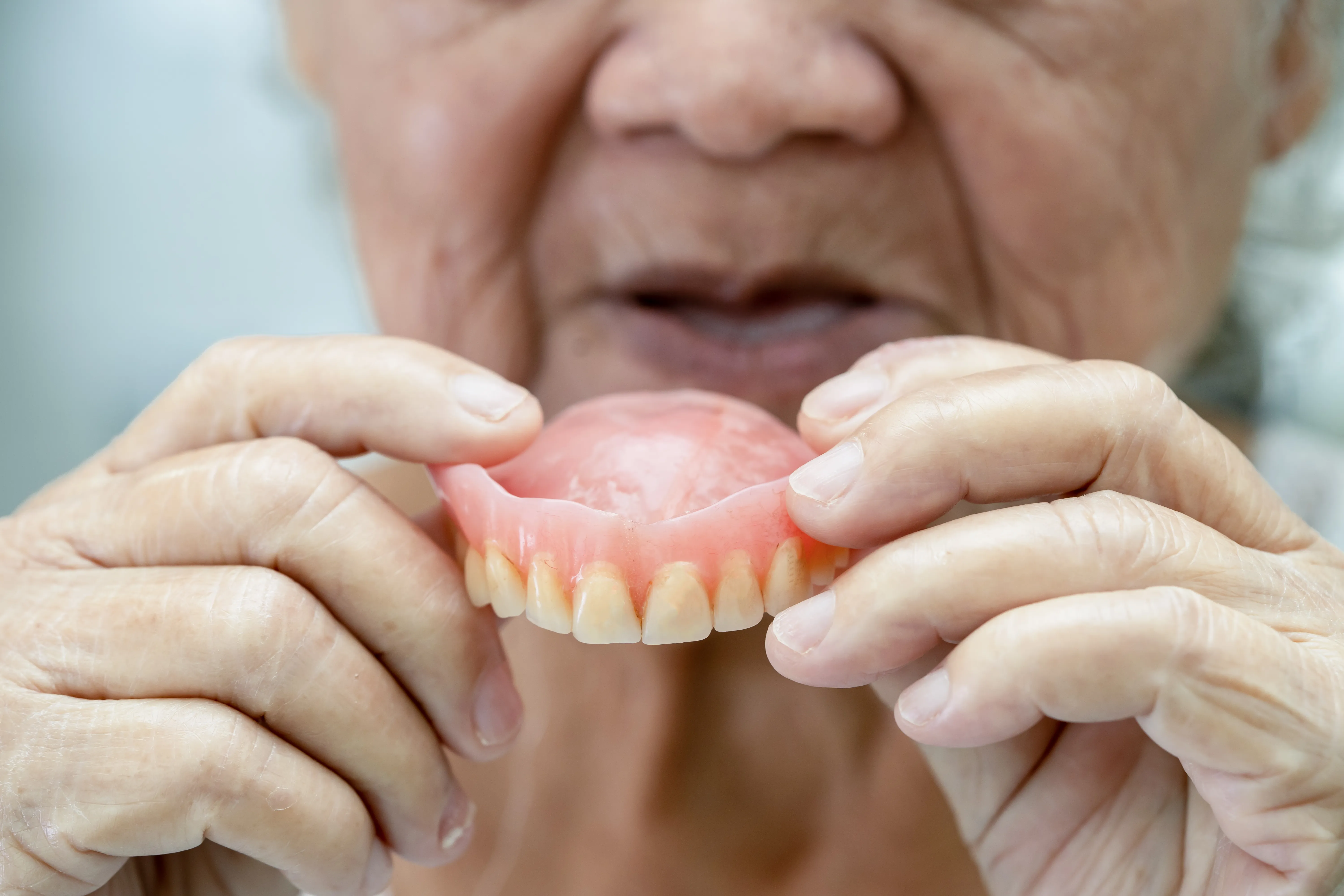 Patient smiling after All-on-X implant placement demonstrating natural appearance and comfort