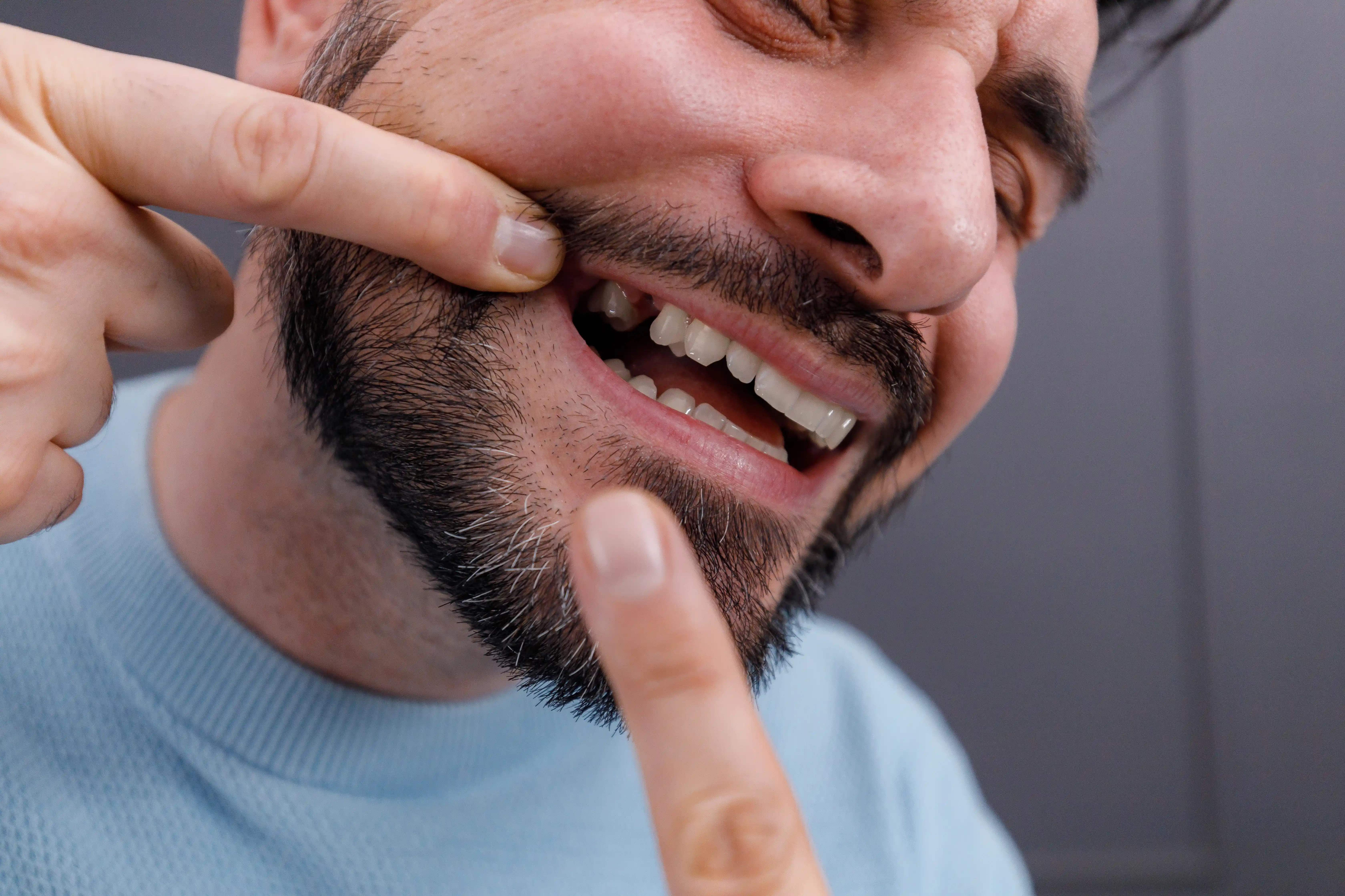 Clinical intraoral photo showing mouth/teeth area with missing tooth gaps