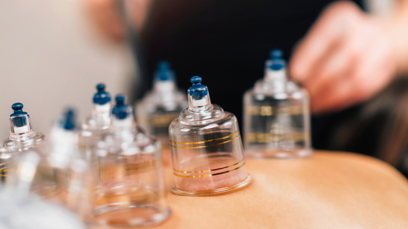oahu cupping treatment