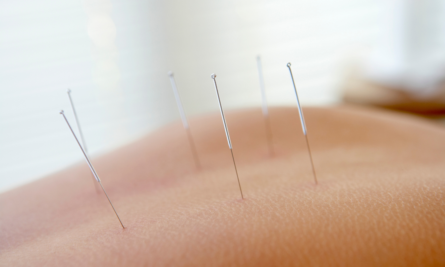 [background image] image of a serene clinic environment (for an acupuncturist)
