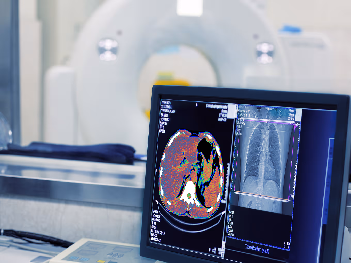 Medical monitor displaying a colored CT scan of the abdomen and a black-and-white chest X-ray, with an MRI machine in the background.