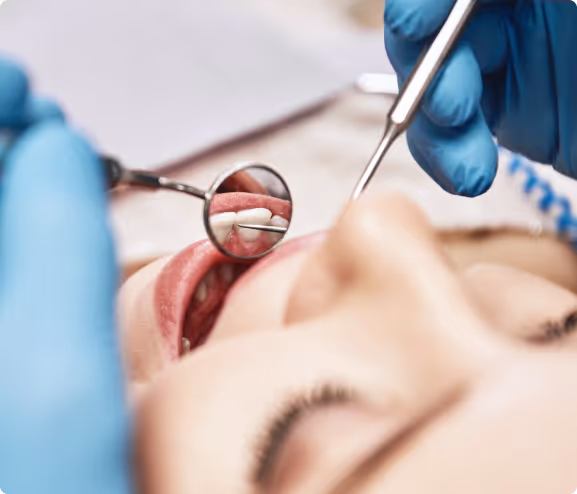 Close-up of dental checkup with dentist’s gloved hands holding tools inside patient’s open mouth.