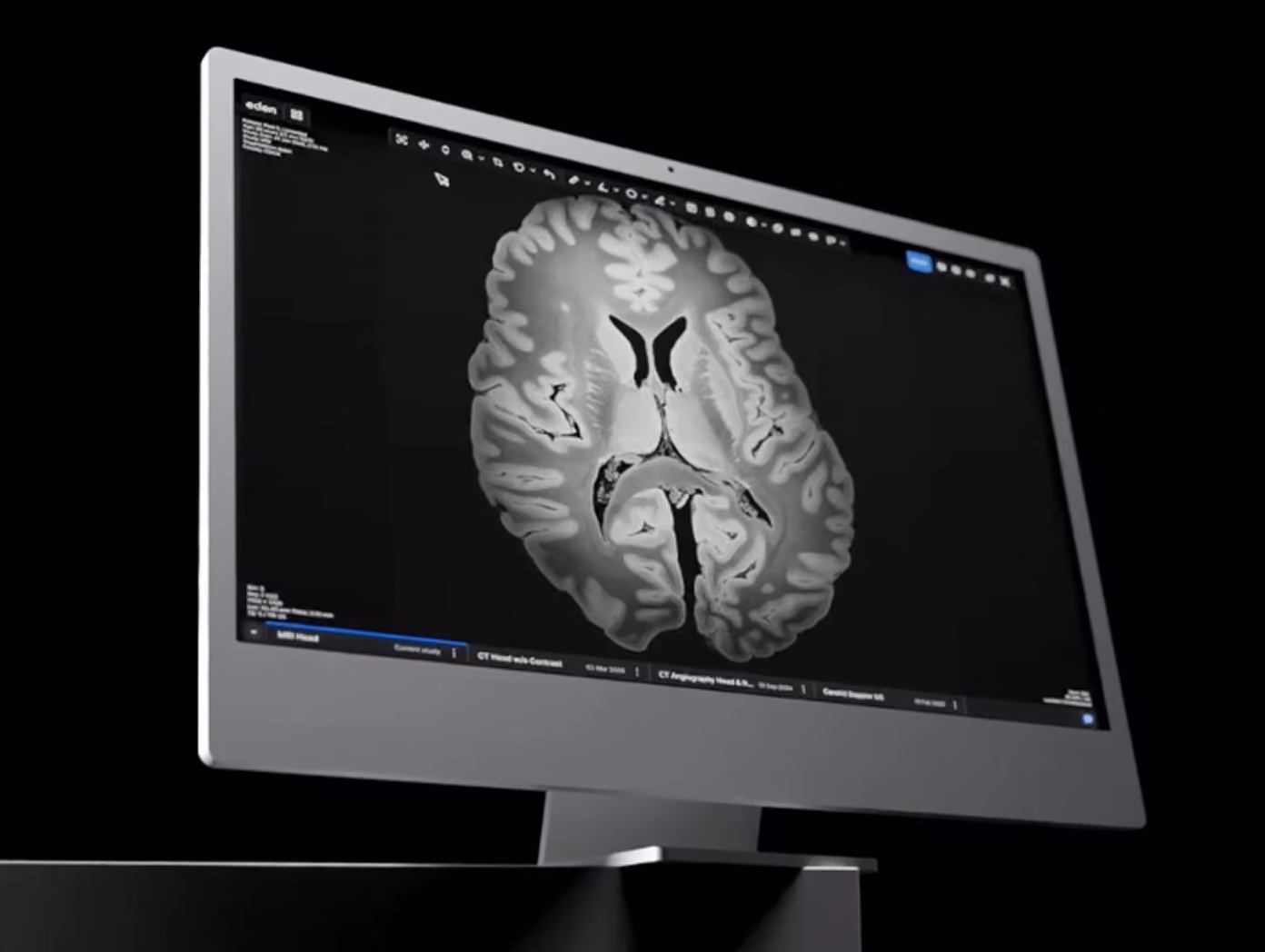 Eden viewer displaying a brain MRI on a desktop monitor