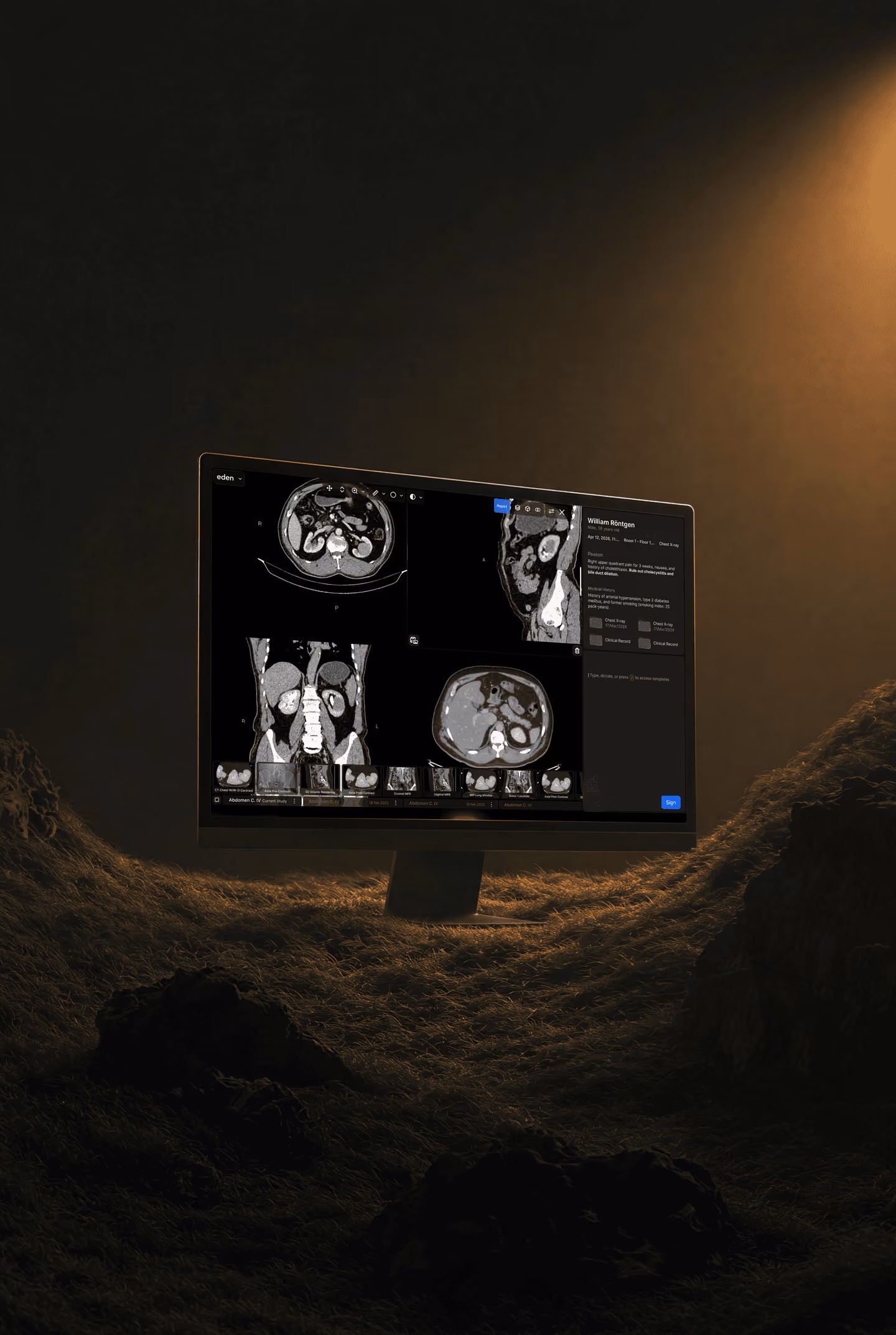 Imaging workstation displaying medical scans in a dimly lit space