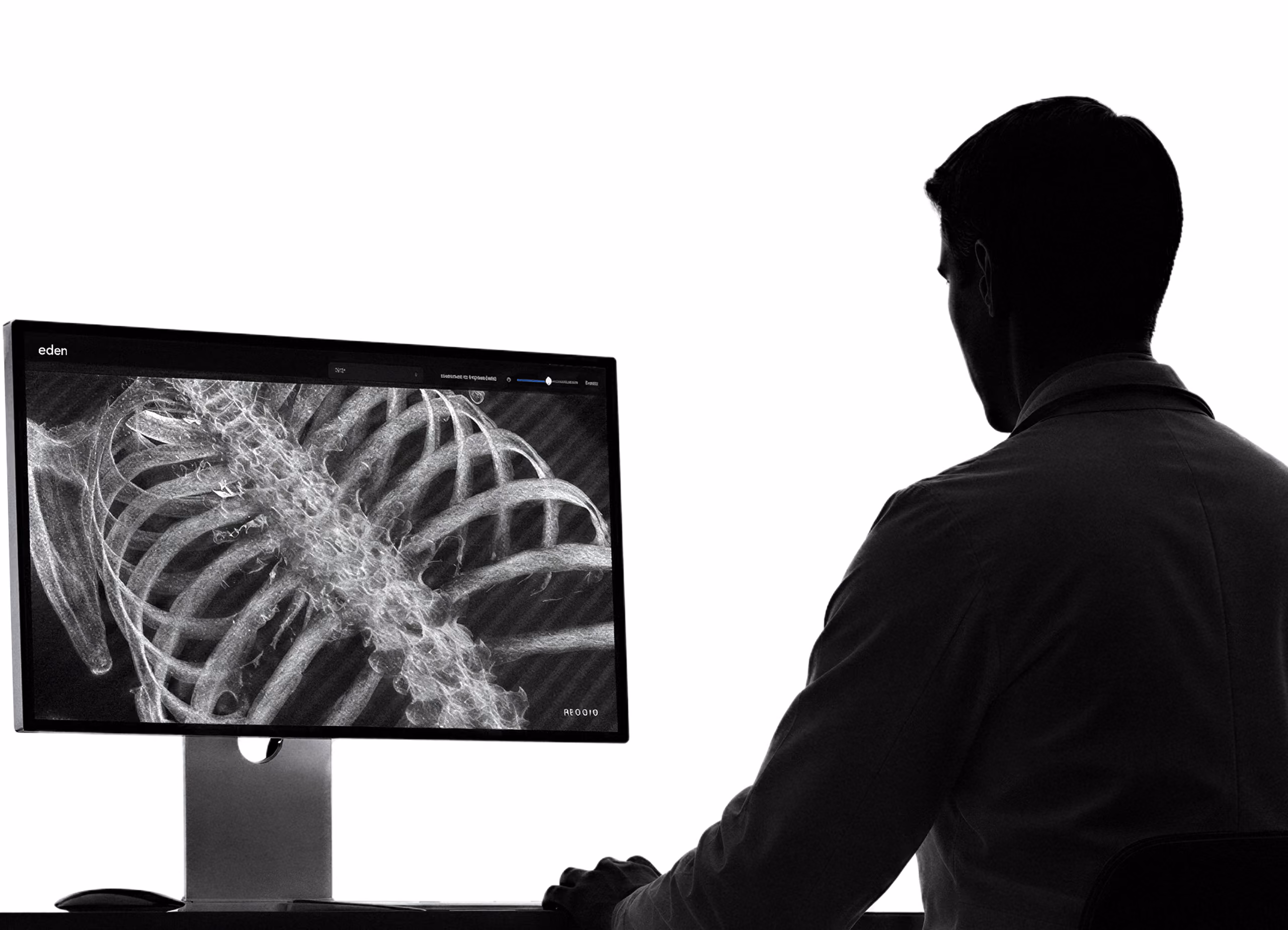 A radiologist reviewing a chest study on the Eden imaging workstation