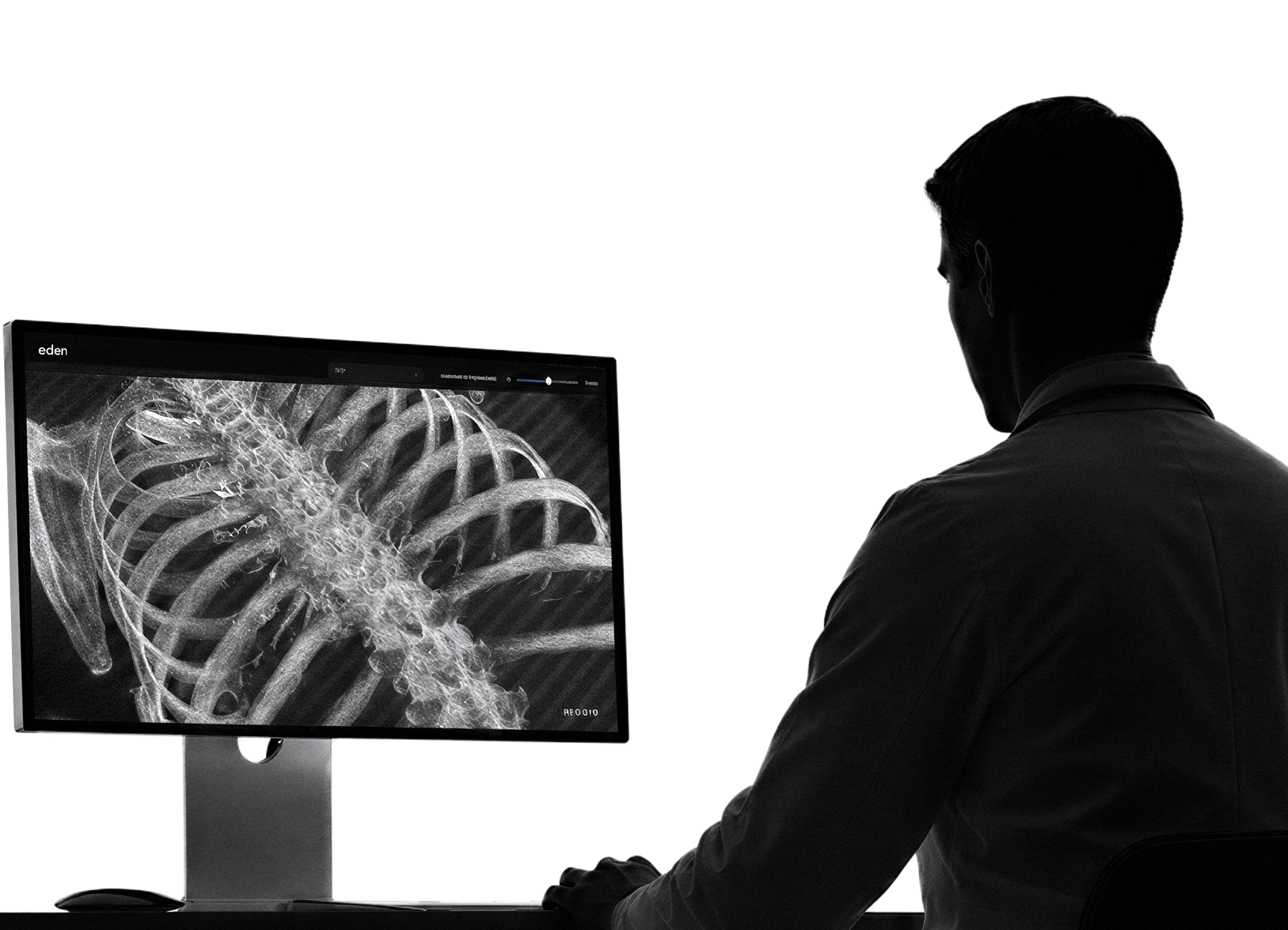 A radiologist reviewing a chest study on the Eden imaging workstation
