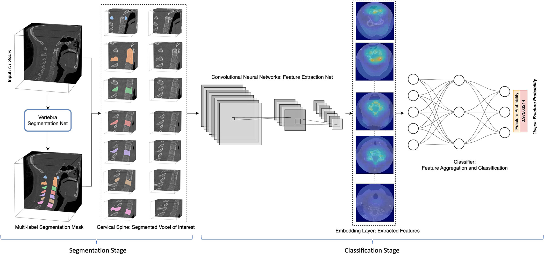 Graphic displays an example of end-to-end architecture of a cervical spine CT fracture detection machine learning model,