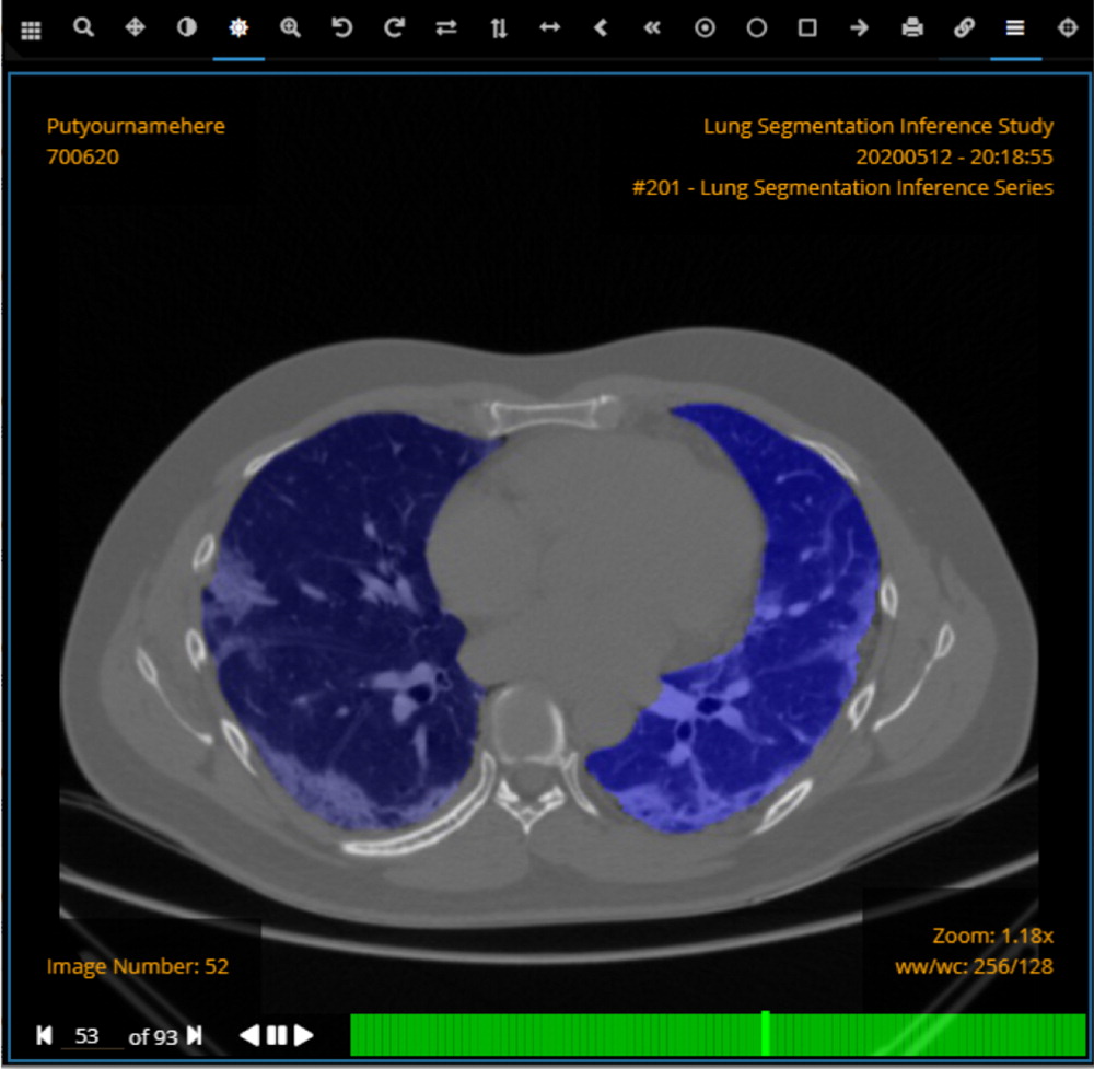 After the new Digital Imaging and Communications in Medicine (DICOM) images are generated, they are sent to the open pic