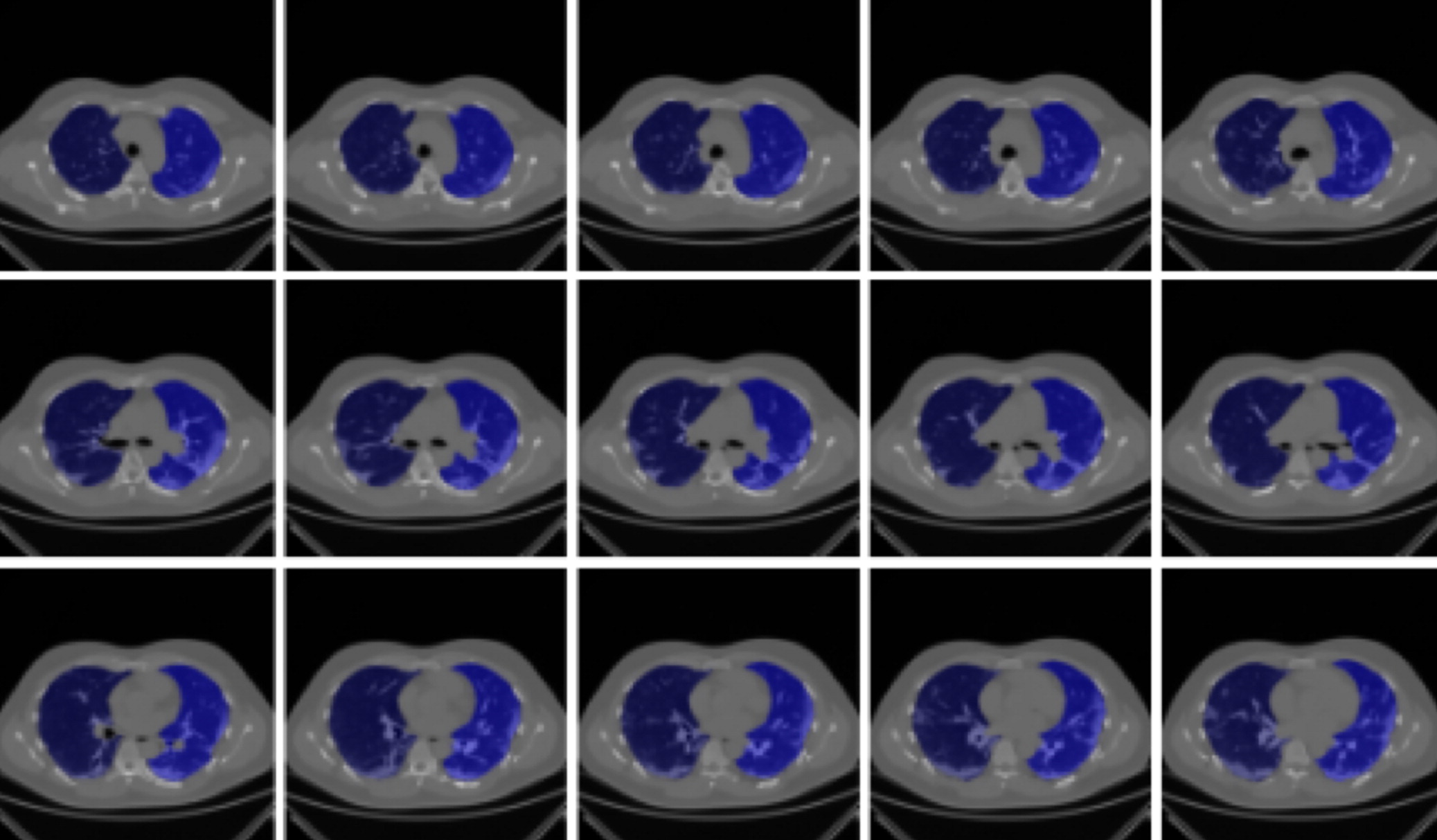 Results of the lung segmentation inference for a few of the images. This displays the CT images, with the inferred lung 