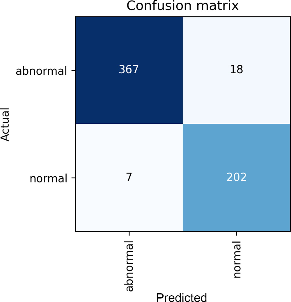 Example confusion matrix generated in the Google Colab notebook using the default values for the training experiment. Up