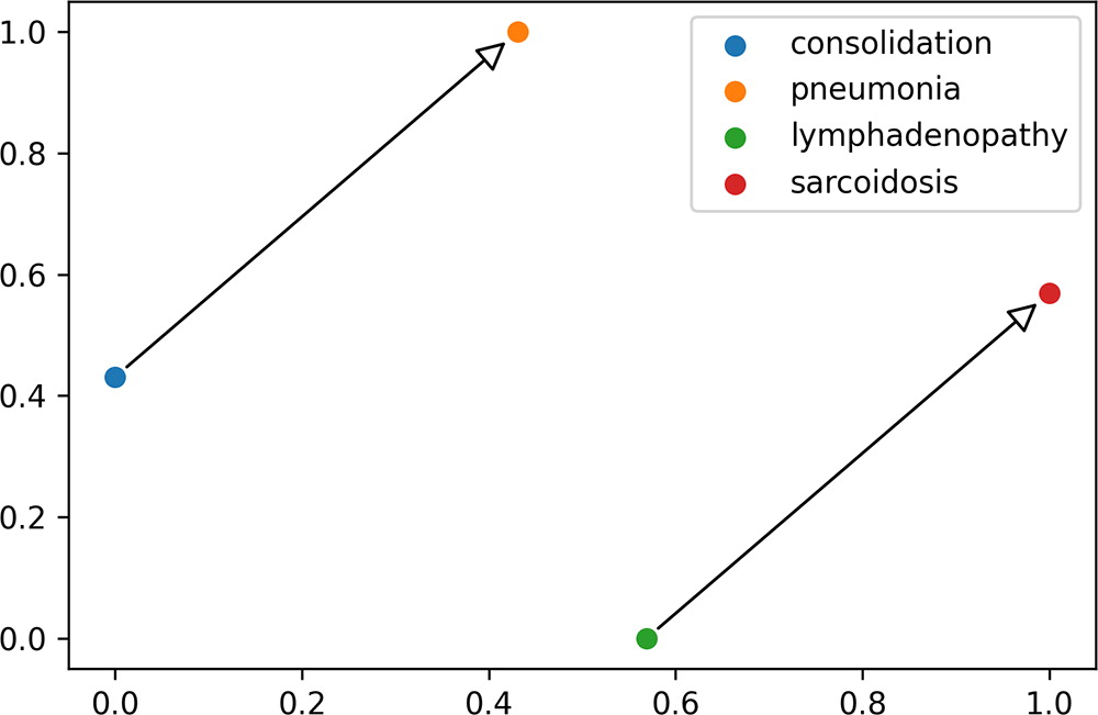 Consider the word analogy problem: “consolidation is to pneumonia as lymphadenopathy is to x ?” Using word embeddings (o