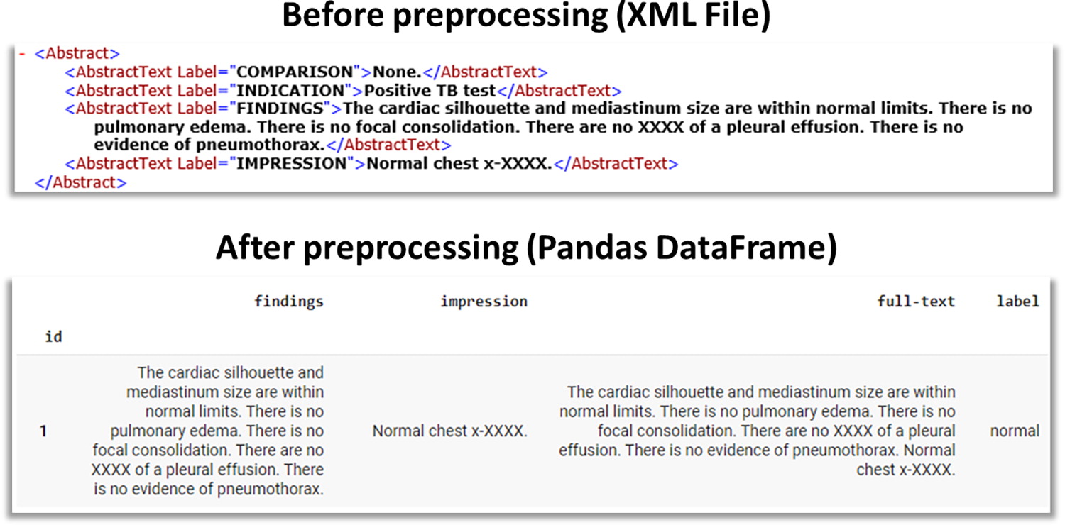 Sample of an XML file containing report data (top). The desired information is extracted to a Pandas DataFrame object af