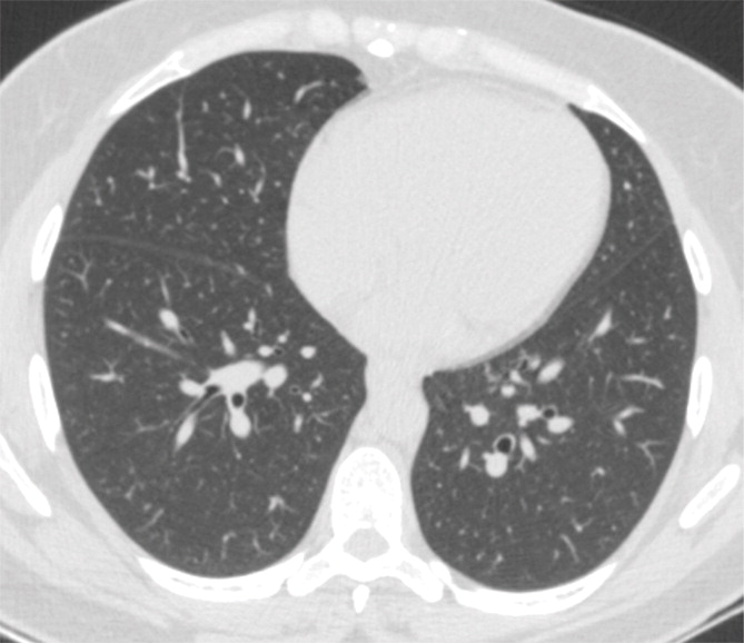 d : Example of CT scans and chest radiographs in the RSNA International COVID-19 Open Radiology Database. (a) Annotated