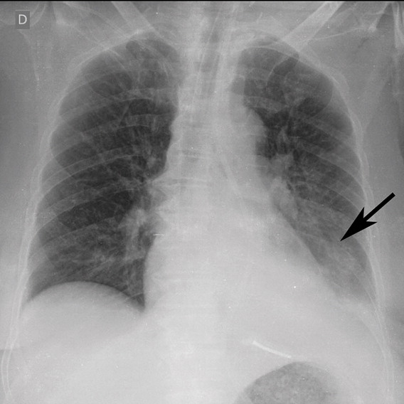 h : Example of CT scans and chest radiographs in the RSNA International COVID-19 Open Radiology Database. (a) Annotated