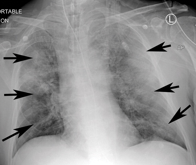 g : Example of CT scans and chest radiographs in the RSNA International COVID-19 Open Radiology Database. (a) Annotated