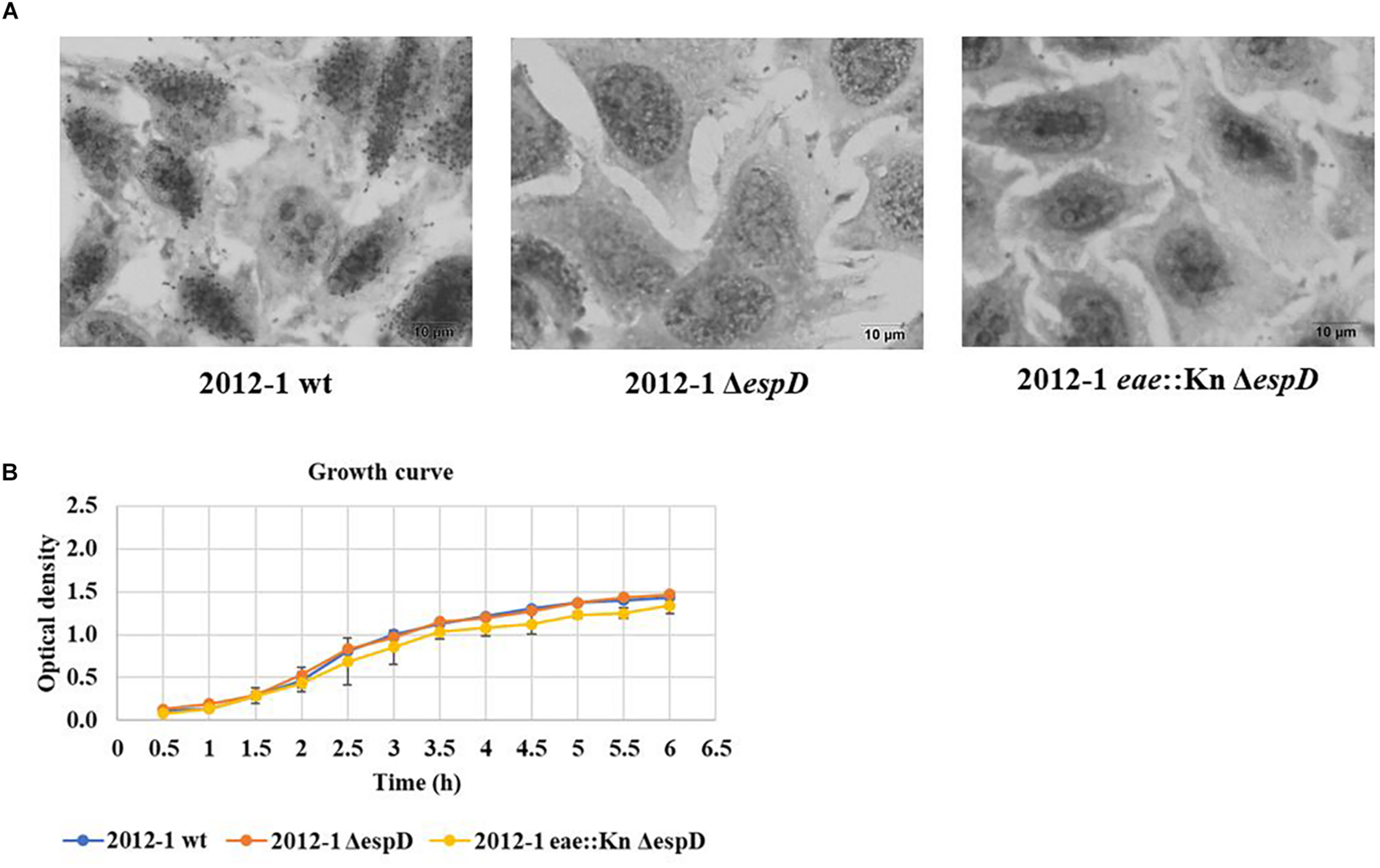 Interaction with HeLa cells of the aEPEC 2012-1 isogenic mutants in the espD and eae genes, after 6 h. (A) The light mic