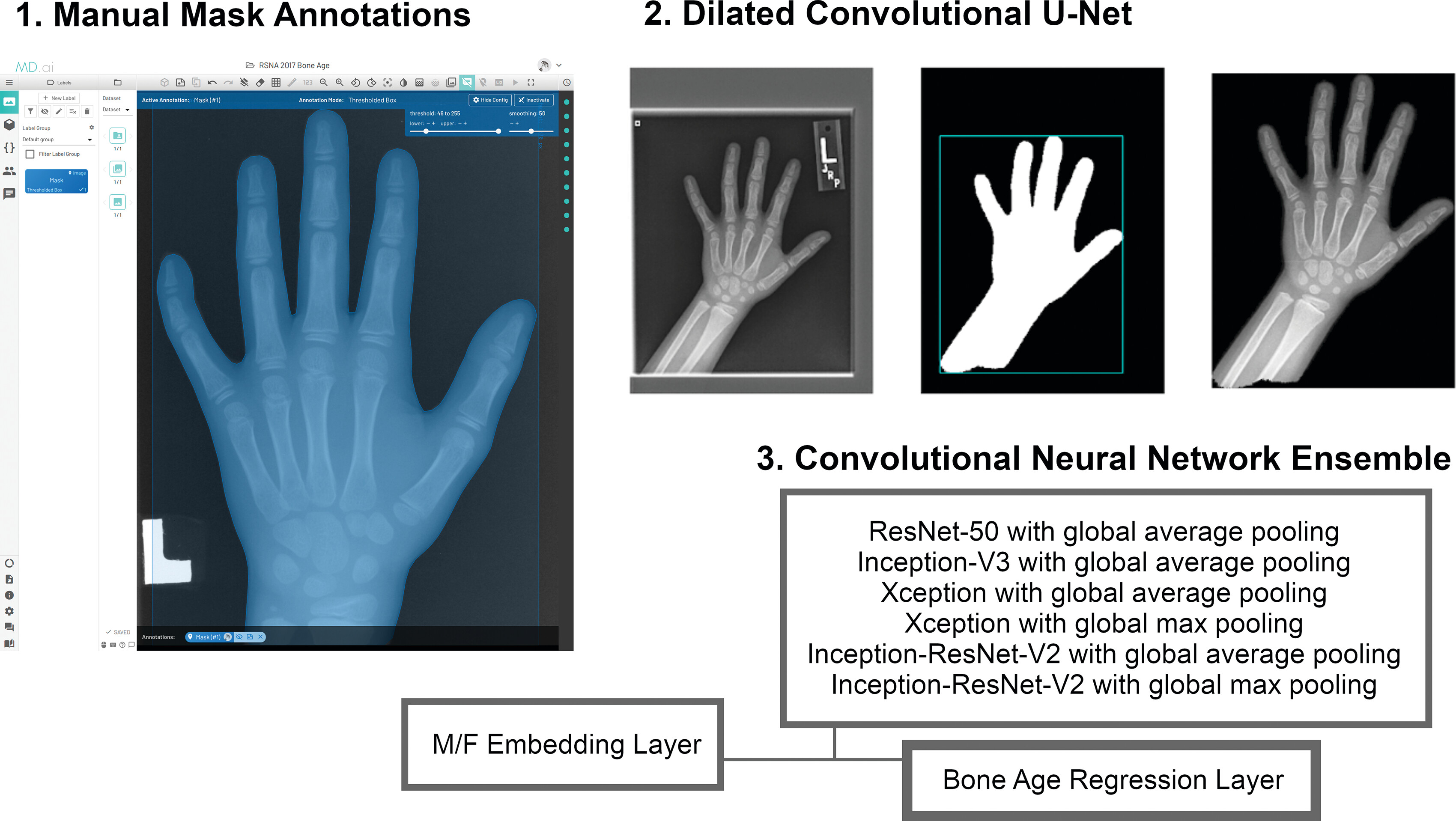 Approximately 400 manual mask annotations were used by the fifth-place team to train a dilated convolutional u-net to ge
