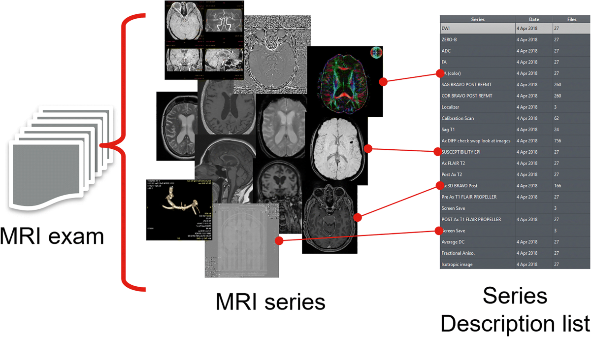 Using DICOM Metadata for Radiological Image Series Categorization