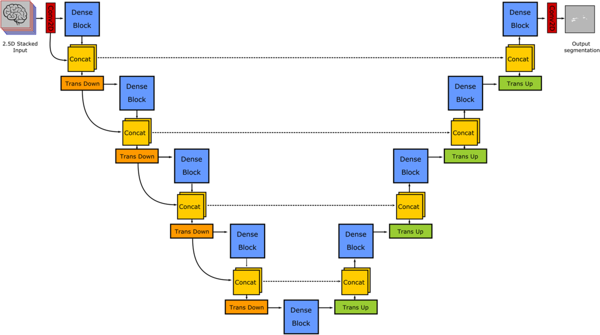 Assessing robustness and generalization of a deep neural network for MS lesion segmentation