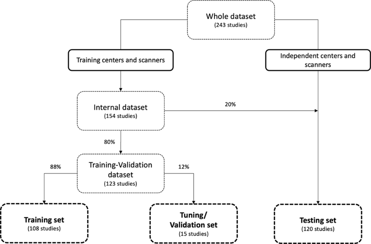 Automated prostate multi-regional segmentation in MRI
