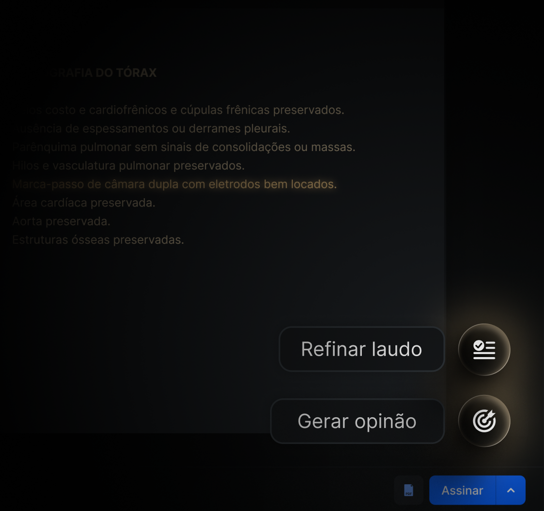 Ações rápidas Refinar laudo e Gerar opinião no Eden PACS