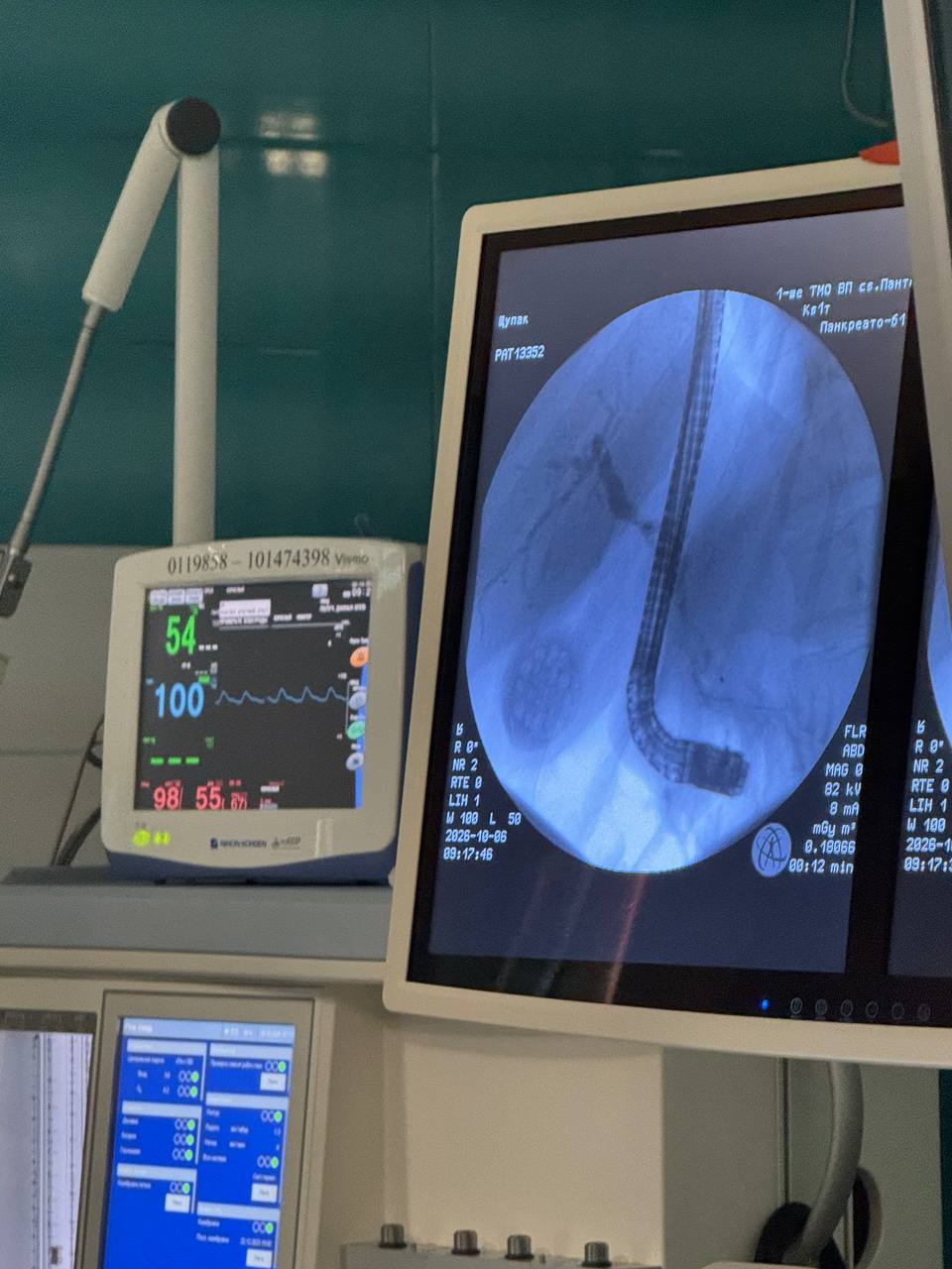 image of a dental treatment in progress